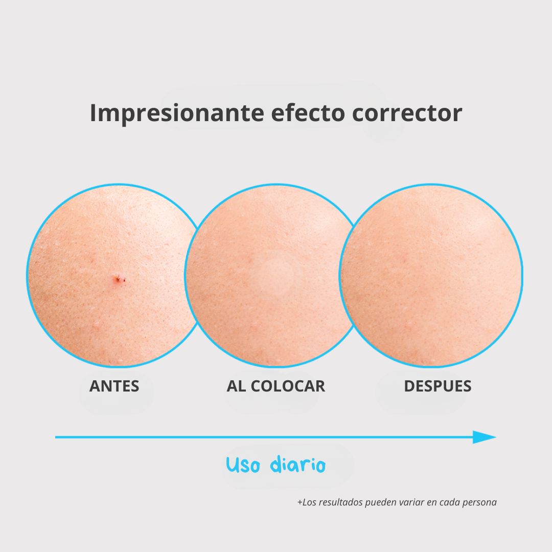 💙 NOLAHOUR Spot Eraser Blue – Spot Recovery (63 Parches)