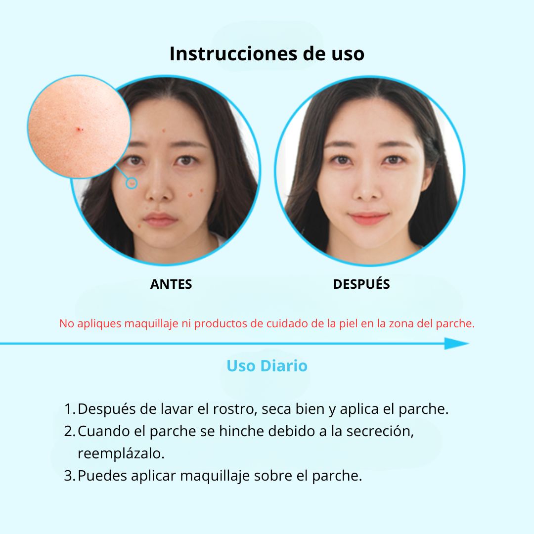 💙 NOLAHOUR Spot Eraser Blue – Spot Recovery (63 Parches)